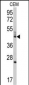 BCL2L13 Antibody (Center)